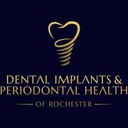 Dental Implants & Periodontal Health